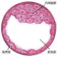 白带异常的治疗误区