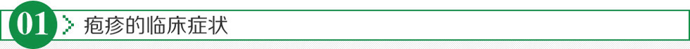 疱疹的临床症状